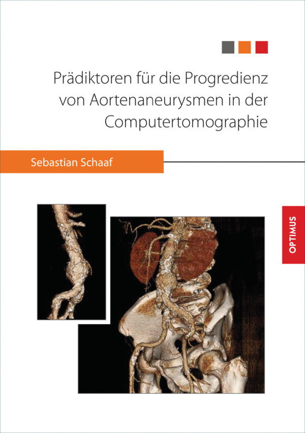 Prädiktoren für die Progredienz von Aortenaneurysmen in der Computertomographie